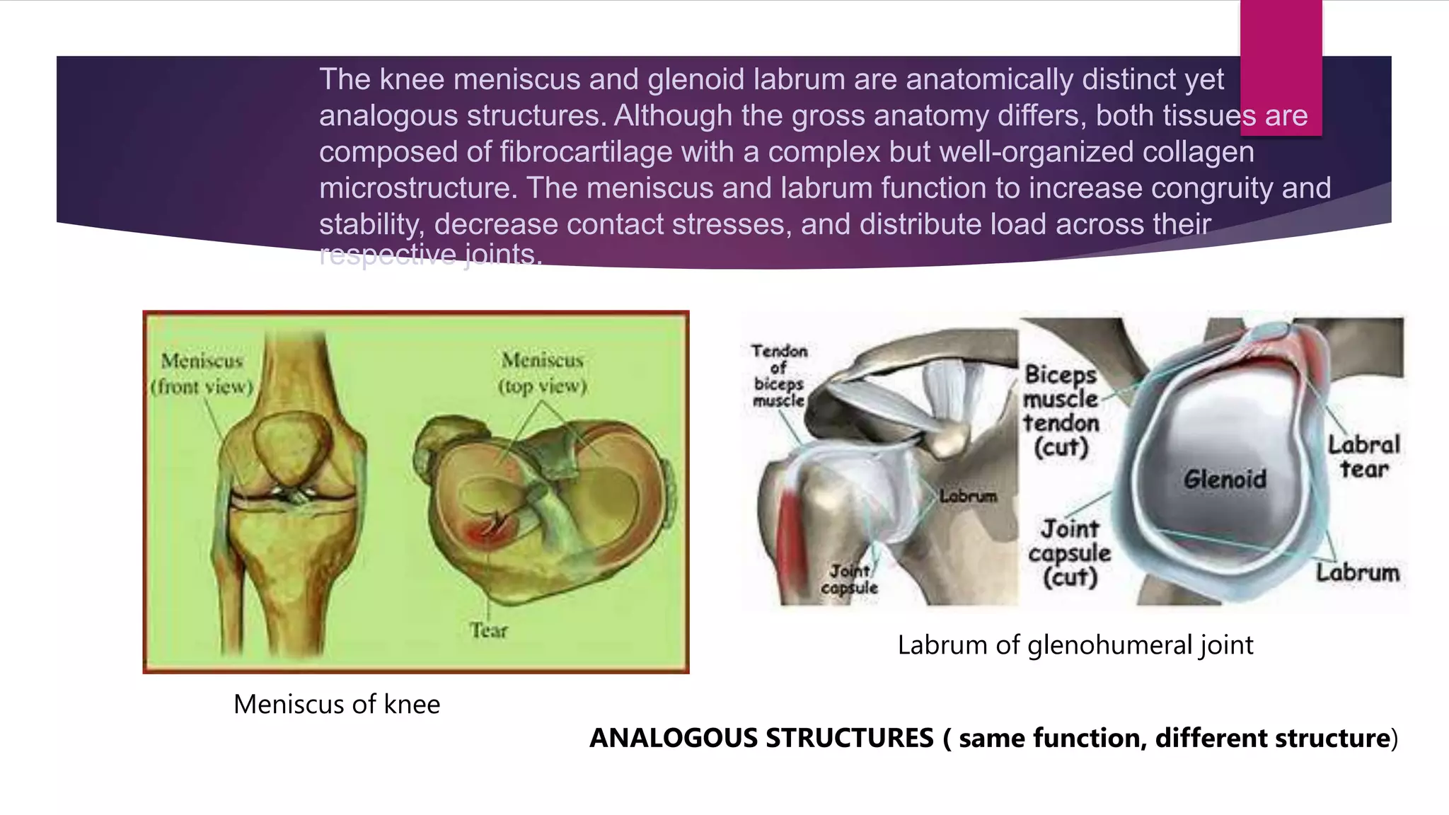 The knee meniscus and glenoid labrum are anatomically distinct yet
analogous structures. Although the gross anatomy differs, both tissues are
composed of fibrocartilage with a complex but well-organized collagen
microstructure. The meniscus and labrum function to increase congruity and
stability, decrease contact stresses, and distribute load across their
respective joints.
Meniscus of knee
Labrum of glenohumeral joint
ANALOGOUS STRUCTURES ( same function, different structure)
 