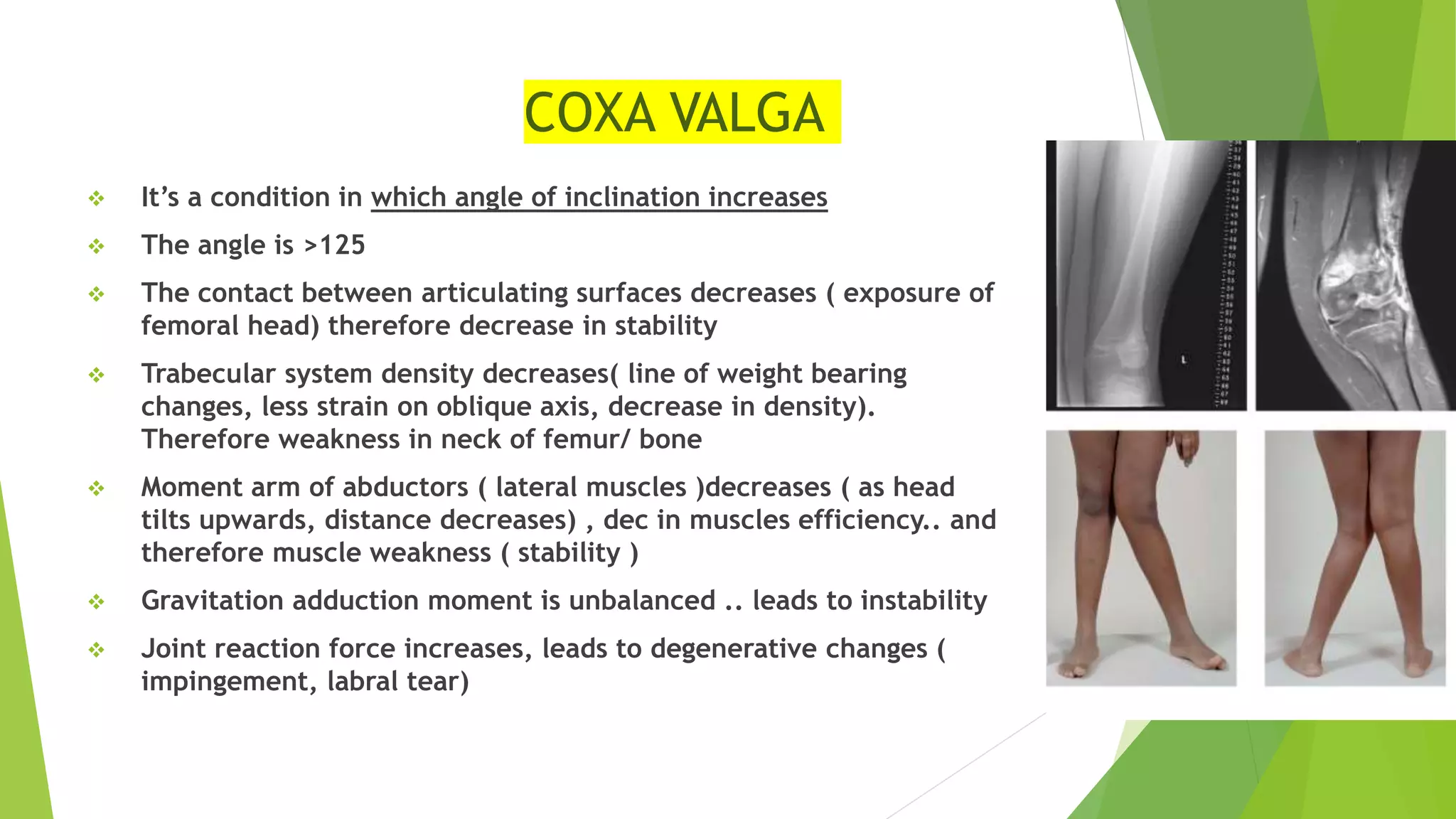 COXA VALGA
 It’s a condition in which angle of inclination increases
 The angle is >125
 The contact between articulating surfaces decreases ( exposure of
femoral head) therefore decrease in stability
 Trabecular system density decreases( line of weight bearing
changes, less strain on oblique axis, decrease in density).
Therefore weakness in neck of femur/ bone
 Moment arm of abductors ( lateral muscles )decreases ( as head
tilts upwards, distance decreases) , dec in muscles efficiency.. and
therefore muscle weakness ( stability )
 Gravitation adduction moment is unbalanced .. leads to instability
 Joint reaction force increases, leads to degenerative changes (
impingement, labral tear)
 