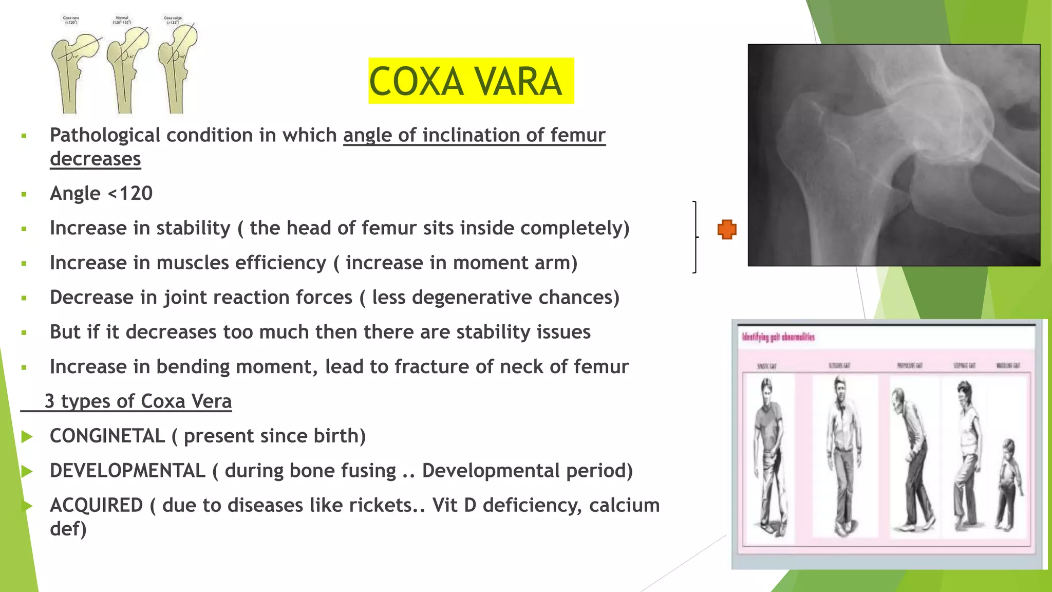 COXA VARA
 Pathological condition in which angle of inclination of femur
decreases
 Angle <120
 Increase in stability ( the head of femur sits inside completely)
 Increase in muscles efficiency ( increase in moment arm)
 Decrease in joint reaction forces ( less degenerative chances)
 But if it decreases too much then there are stability issues
 Increase in bending moment, lead to fracture of neck of femur
3 types of Coxa Vera
 CONGINETAL ( present since birth)
 DEVELOPMENTAL ( during bone fusing .. Developmental period)
 ACQUIRED ( due to diseases like rickets.. Vit D deficiency, calcium
def)
 