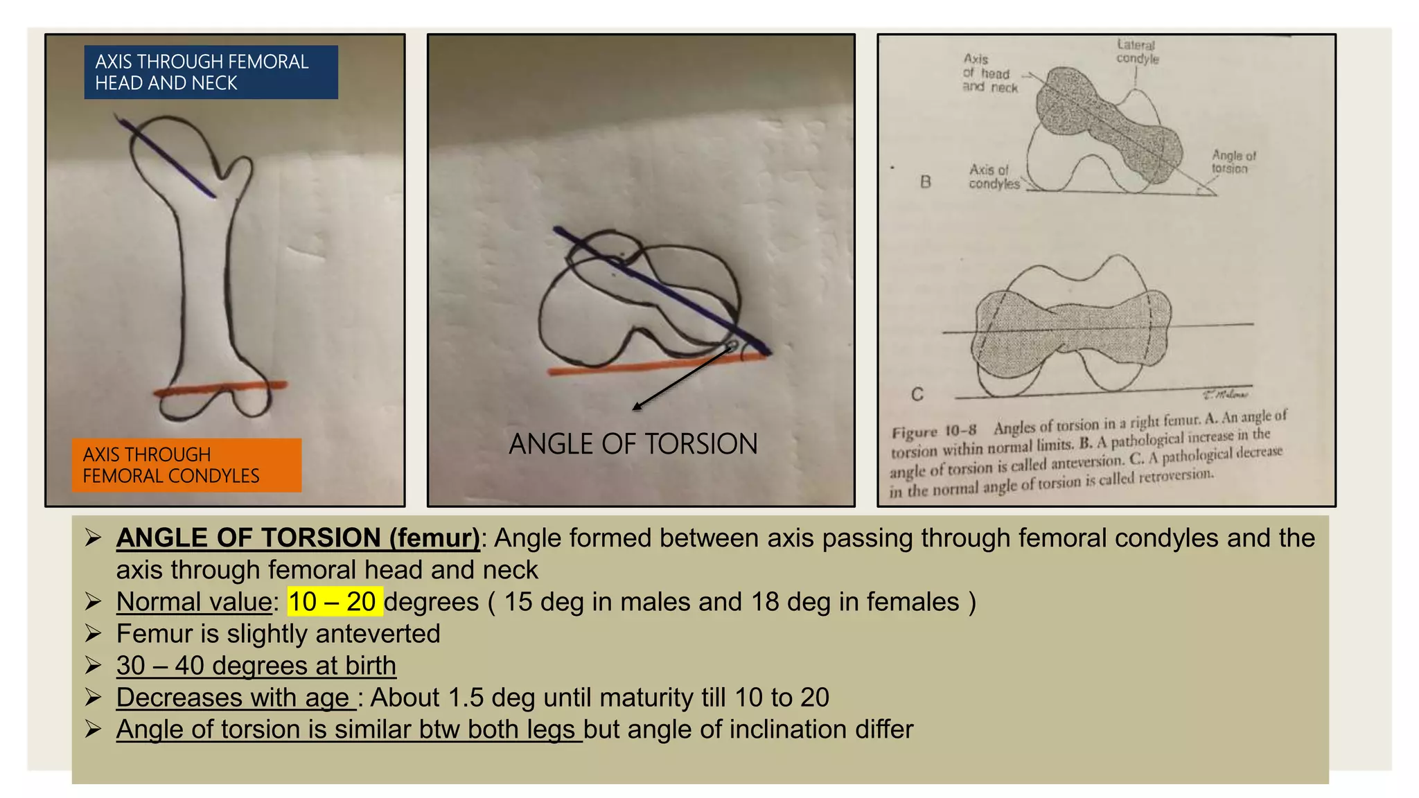AXIS THROUGH
FEMORAL CONDYLES
AXIS THROUGH FEMORAL
HEAD AND NECK
ANGLE OF TORSION
 ANGLE OF TORSION (femur): Angle formed between axis passing through femoral condyles and the
axis through femoral head and neck
 Normal value: 10 – 20 degrees ( 15 deg in males and 18 deg in females )
 Femur is slightly anteverted
 30 – 40 degrees at birth
 Decreases with age : About 1.5 deg until maturity till 10 to 20
 Angle of torsion is similar btw both legs but angle of inclination differ
 