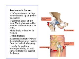 1) Trochanteric Bursae:
2) is inflammation to the hip
located on the tip of greater
trochanter.
3) Is common cause of hip
pain. Most often caused by
overuse or direct trauma to
joint.
4) More likely to involve in
women.
5) Ischial Bursae:
6) inflammation that separates
the gluteal maximus muscle
from the Ischial tuberosity.
7) Usually formed from
prolonged sitting on hard
surfaces that press against
the bones.
 