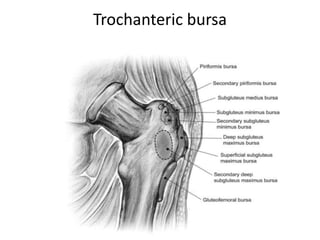 Trochanteric bursa
 