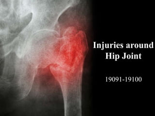 Injuries around
Hip Joint
19091-19100
 