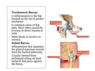 1) Trochanteric Bursae:
2) is inflammation to the hip
located on the tip of greater
trochanter.
3) Is common cause of hip
pain. Most often caused by
overuse or direct trauma to
joint.
4) More likely to involve in
women.
5) Ischial Bursae:
6) inflammation that separates
the gluteal maximus muscle
from the Ischial tuberosity.
7) Usually formed from
prolonged sitting on hard
surfaces that press against
the bones.
 