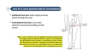 Contralateral Hand Use Biomechanics of the Hip Joint or Hip complex | PPTX