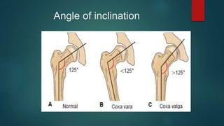 Hip mobilization.pptx