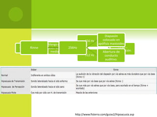 http://www.fisterra.com/guias2/hipoacusia.asp