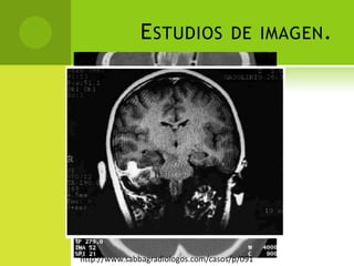 Estudios de imagen.http://www.sabbagradiologos.com/casos/p/091