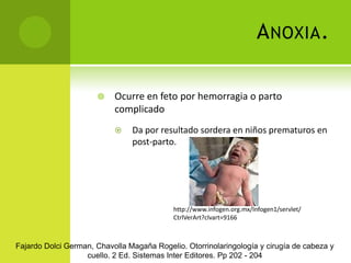 Enfermedades infecciosas adquiridas como otitis  media.