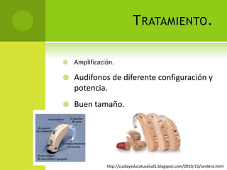 Presbiacusia4 tipos de presbiacusiaSensorial.- tonos altos, disminución súbita, bilateral y simétrica.Neural.- perdida de neuronas cocleares en casi su totalidad. Perdida grave en discriminación del habla. Audiometría decreciente con inclinación variable.Estrial.- todas las frecuencias (perdida mínima). Audiometría aplanada de tonos puros con excelente discriminación del habla. Es por atrofia de la estría vascular en giro medio y apical de la cóclea sin perdida de neuronas.Conductiva.- tonos altos, disminución gradual. Se sugiere que es por cambios en características mecánicas de la membrana basilar.Fajardo Dolci German, Chavolla Magaña Rogelio. Otorrinolaringología y cirugía de cabeza y cuello. 2 Ed. Sistemas Inter Editores. Pp 202 - 204
