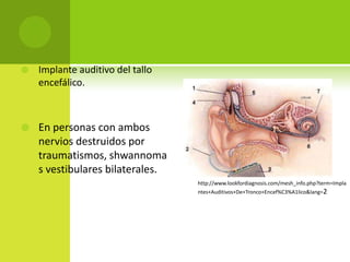 Tratamiento.Amplificación.Audifonos de diferente configuración y potencia.Buen tamaño.http://cuidayeducatusalud1.blogspot.com/2010/11/sordera.html