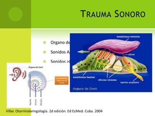 Imersión prolongadaBarotraumaVuelo no presurizadoGrandesesfuerzosLalwani Anil K. Diagnóstico y Tratamiento en otorrinolaringologia, cirugia de cabeza y cuello.  2 Ed. Manual Moderno.