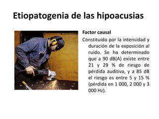 Etiopatogenia de las hipoacusias
Factor causal
Constituido por la intensidad y
duración de la exposición al
ruido. Se ha determinado
que a 90 dB(A) existe entre
21 y 29 % de riesgo de
pérdida auditiva, y a 85 dB
el riesgo es entre 5 y 15 %
(pérdida en 1 000, 2 000 y 3
000 Hz).
 
