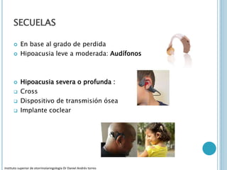 SECUELAS
 En base al grado de perdida
 Hipoacusia leve a moderada: Audífonos
 Hipoacusia severa o profunda :
 Cross
 Dispositivo de transmisión ósea
 Implante coclear
Instituto superior de otorrinolaringología Dr Daniel Andrés torres
 