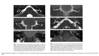 Abele TA, Besachio DA, Quigley EP, et al. Diagnostic accuracy of screening MR imaging using unenhanced axial CISS and coronal T2WI for detection of small internal auditory canal lesions. Am J Neuroradiol. 2014;35:2366-
2370.
 