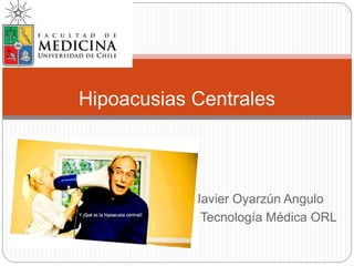 Javier Oyarzún Angulo
III° Tecnología Médica ORL
Hipoacusias Centrales
 