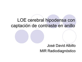 LOE cerebral hipodensa con
captación de contraste en anillo
José David Albillo
MIR Radiodiagnóstico
 