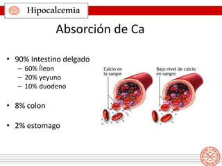 Hipocalcemia
Absorción de Ca
• 90% Intestino delgado
– 60% Íleon
– 20% yeyuno
– 10% duodeno
• 8% colon
• 2% estomago
 