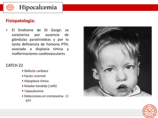 • El Sindrome de Di Gorge: se
caracteriza por ausencia de
glándulas paratiriodeas y por lo
tanto deficiencia de homona PTH,
asociado a displasia timica y
malformaciones cardiovasculares
CATCH 22
• Defecto cardiaco
• Facies anormal
• Hipoplasia tímica
• Paladar hendido (cleft)
• Hipocalcemia
• Delecciones en cromosoma 22
q11
Hipocalcemia
Fisiopatología:
 