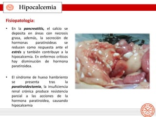 • En la pancreatitis, el calcio se
deposita en áreas con necrosis
grasa, además, la secreción de
hormonas paratiroideas se
reducen como respuesta ante el
estrés y también contribuye a la
hipocalcemia. En enfermos críticos
hay disminución de hormona
paratiroidea.
• El síndrome de hueso hambriento
se presenta tras la
paratiroidectomia, la insuficiencia
renal crónica produce resistencia
parcial a las acciones de la
hormona paratiroidea, causando
hipocalcemia
Hipocalcemia
Fisiopatología:
 