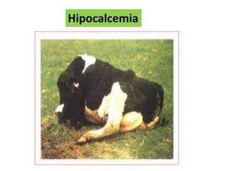 Hipocalcemia
 