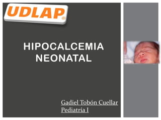 HIPOCALCEMIA
NEONATAL

Gadiel Tobón Cuellar
Pediatría I

 