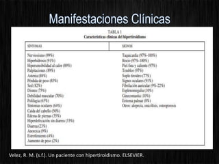 Velez, R. M. (s.f.). Un paciente con hipertiroidismo. ELSEVIER.
 