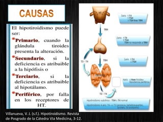 Villanueva, V. J. (s.f.). Hipotiroidismo. Revista
de Posgrado de la Cátedra VIa Medicina, 3-12.
 