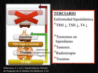 TERCIARIO
Enfermedad hipotalámica
*TRH ↓, TSH ↓, T4 ↓
*Trastornos en
hipotálamo
*Tumores.
*Radioterapia
*Traumas
*Formas infiltrantes
Villanueva, V. J. (s.f.). Hipotiroidismo. Revista
de Posgrado de la Cátedra VIa Medicina, 3-12.
 