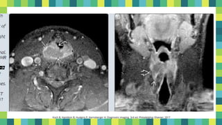 12
Koch B, Hamilton B, Hudgins P, Harnsberger H. Diagnostic imaging. 3rd ed. Philadelphia: Elsevier; 2017
 