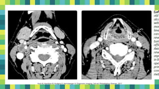 13
Koch B, Hamilton B, Hudgins P, Harnsberger H. Diagnostic imaging. 3rd ed. Philadelphia: Elsevier; 2017
 