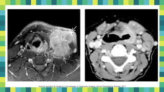 14
Koch B, Hamilton B, Hudgins P, Harnsberger H. Diagnostic imaging. 3rd ed. Philadelphia: Elsevier; 2017
 