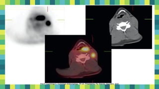 15
Flint P, Cummings C. Cummings otolaryngology. 7th ed. Philadelphia, Pa: Elsevier, Saunders; 2020
 