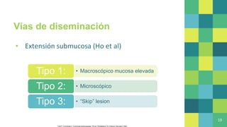 Vías de diseminación
▪ Extensión submucosa (Ho et al)
19
Flint P, Cummings C. Cummings otolaryngology. 7th ed. Philadelphia, Pa: Elsevier, Saunders; 2020
• Macroscópico mucosa elevada
Tipo 1:
• Microscópico
Tipo 2:
• “Skip” lesion
Tipo 3:
 