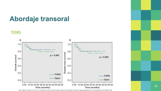 Abordaje transoral
TORS
42
Park Y, Byeon H, Chung H, Choi E, Kim S. Comparison study of transoral robotic surgery and radical open surgery for hypopharyngeal cancer. Acta Otolaryngol. 2013;133(6):641-648.
 
