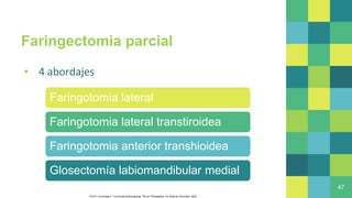 Faringectomia parcial
▪ 4 abordajes
47
Faringotomia lateral
Faringotomia lateral transtiroidea
Faringotomia anterior transhioidea
Glosectomía labiomandibular medial
Flint P, Cummings C. Cummings otolaryngology. 7th ed. Philadelphia, Pa: Elsevier, Saunders; 2020
 