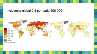 Incidencia global 0.8 por cada 100 000
♂ ♀
Bradley P. Epidemiology of Hypopharyngeal Cancer. Adv Otorhinolaryngol. 2019;83:1-14.
 