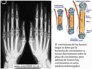El  crecimiento de los huesos largos se debe que la hormona de crecimiento va actuar directamente sobre la placa de crecimiento, pero además de huesos hay crecimientos en otros tejidos(cardiomegalia) 