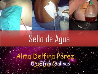 Sello de Agua
Alma Delfina Pérez
Dr. EfrénO
De La Salinas

 