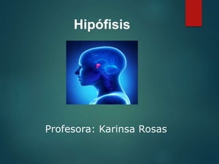 Hipófisis
Profesora: Karinsa Rosas
 