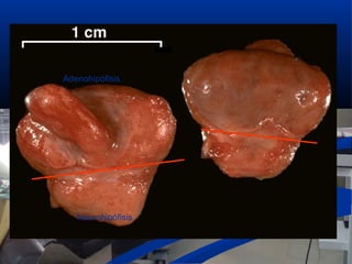Adenohipófisis
Neurohipófisis
 