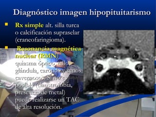 Diagnóstico imagen hipopituitarismoDiagnóstico imagen hipopituitarismo
 Rx simpleRx simple alt. silla turcaalt. silla turca
o calcificación supraselaro calcificación supraselar
(craneofaringioma).(craneofaringioma).
 Resonancia magnéticaResonancia magnética
nuclear (RMNnuclear (RMN))
quiasma óptico, tallo,quiasma óptico, tallo,
glándula, carótida y senosglándula, carótida y senos
cavernosos. Si no escavernosos. Si no es
posible (claustrofobia,posible (claustrofobia,
presencia depresencia de metal)metal)
puede realizarse un TACpuede realizarse un TAC
de alta resolución.de alta resolución.
 