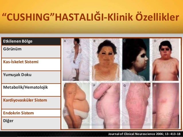 hipertansiyon reçete örnekleri - Bu ne?