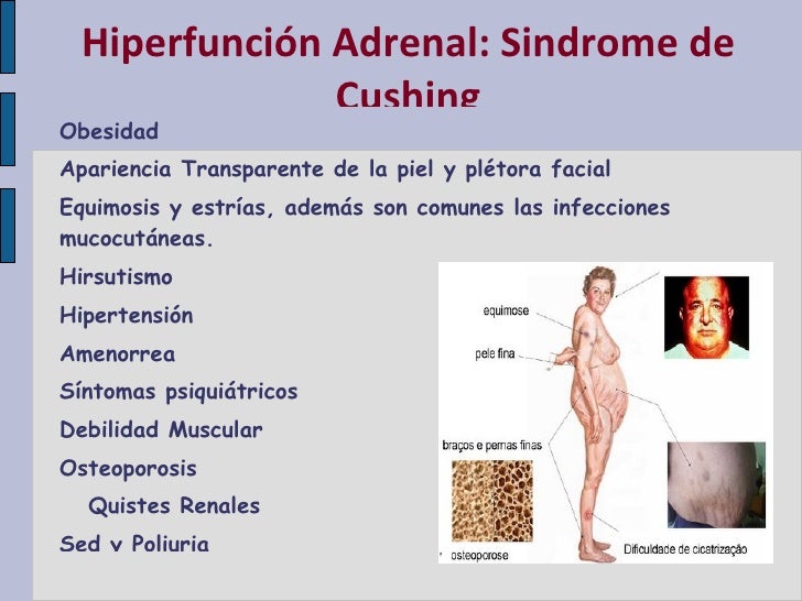 Hipofuncion E Hiperfuncion Adrenal