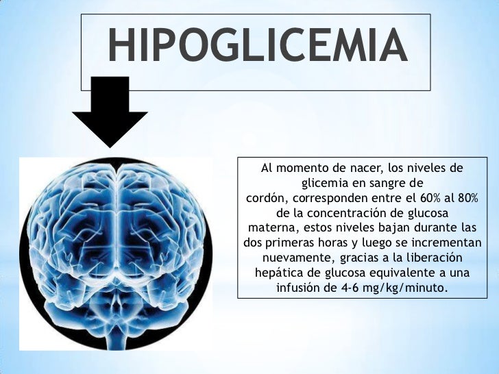 Hipoglicemia del recien nacido Hipoglicemia del recien nacido