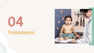 Tratamento
04
 
