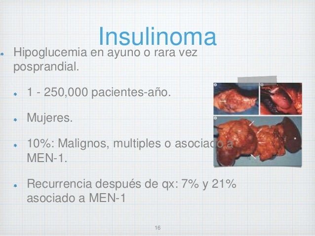 Abordaje diagnostico y tratamiento Hipoglucemia Abordaje diagnostico y tratamiento Hipoglucemia