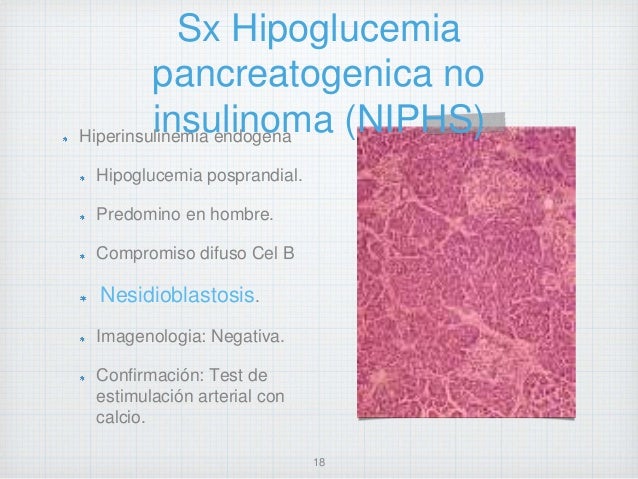 Abordaje diagnostico y tratamiento Hipoglucemia Abordaje diagnostico y tratamiento Hipoglucemia