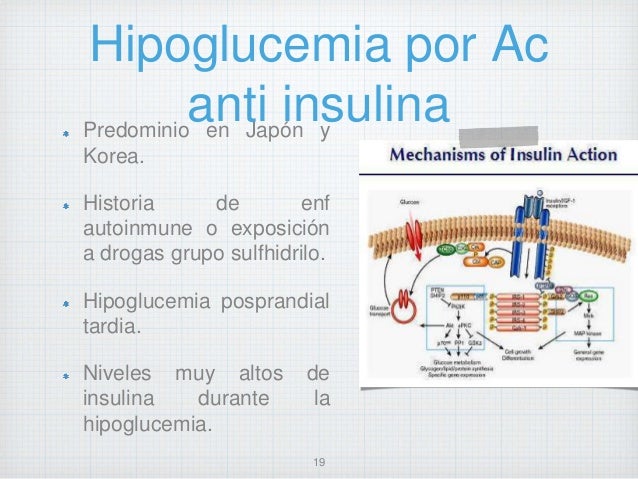 Abordaje diagnostico y tratamiento Hipoglucemia Abordaje diagnostico y tratamiento Hipoglucemia