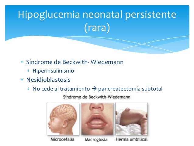 Hipoglucemia neonatal Hipoglucemia neonatal